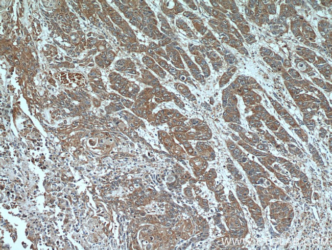 PRL3 Antibody in Immunohistochemistry (Paraffin) (IHC (P))