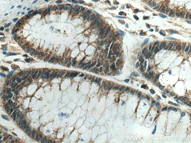 PRL3 Antibody in Immunohistochemistry (Paraffin) (IHC (P))