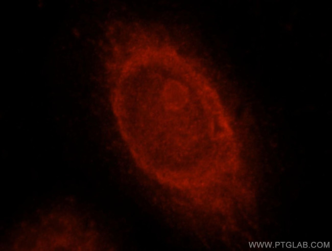 RBPMS Antibody in Immunocytochemistry (ICC/IF)