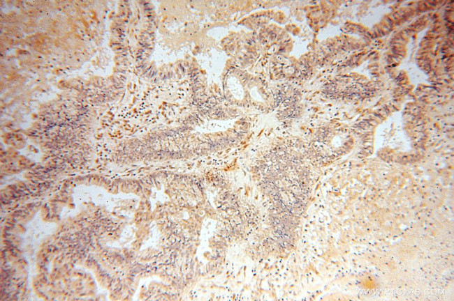 RBPMS Antibody in Immunohistochemistry (Paraffin) (IHC (P))