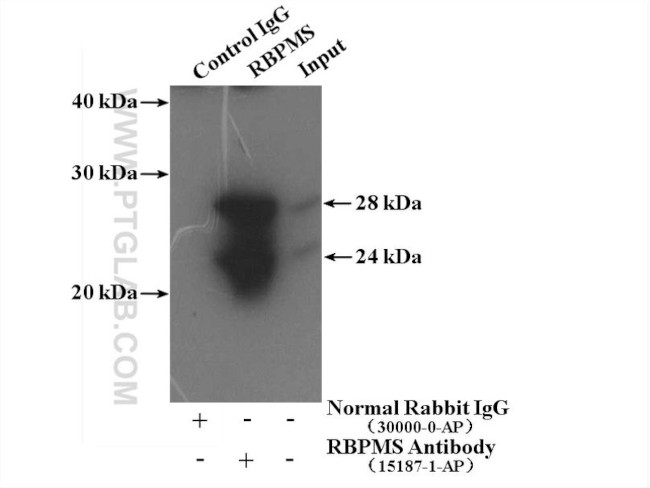RBPMS Antibody in Immunoprecipitation (IP)