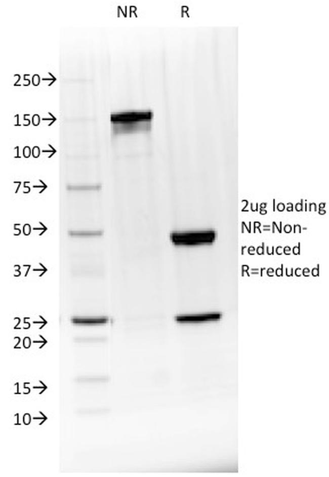 BTLA Antibody in Immunoelectrophoresis (IE)