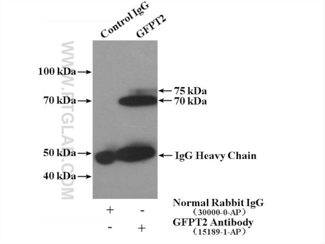 GFPT2 Antibody in Immunoprecipitation (IP)