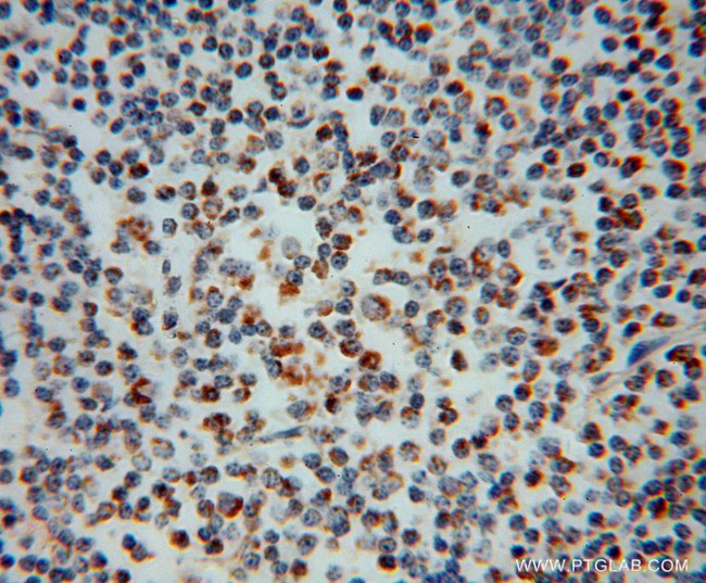 MRPL37 Antibody in Immunohistochemistry (Paraffin) (IHC (P))