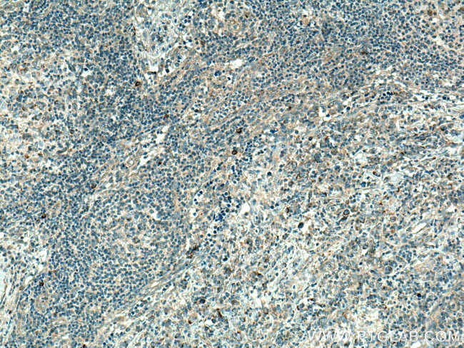 MRPL37 Antibody in Immunohistochemistry (Paraffin) (IHC (P))