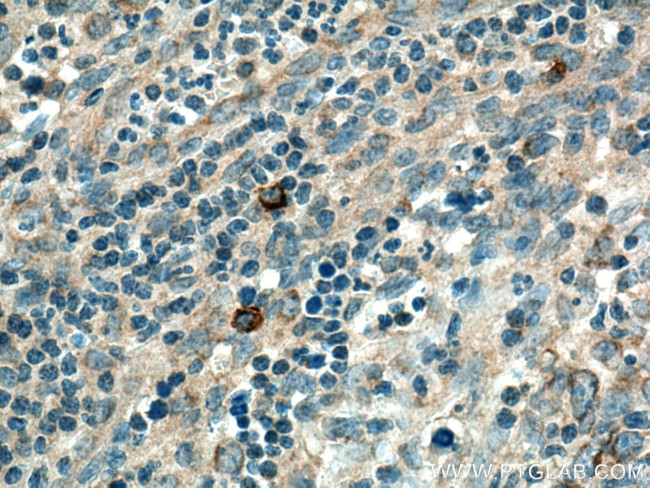 MRPL37 Antibody in Immunohistochemistry (Paraffin) (IHC (P))