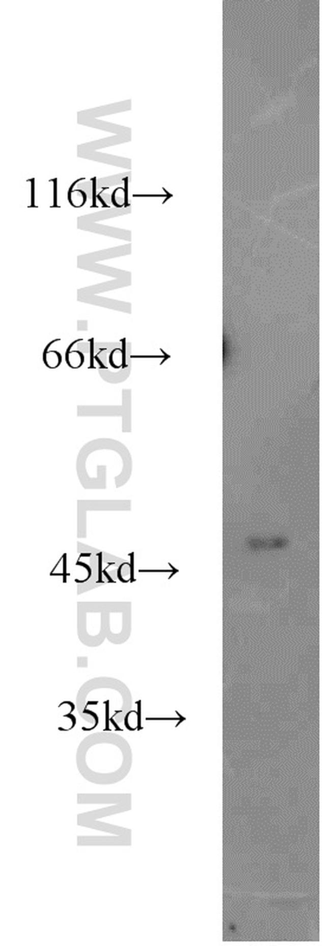 MRPL37 Antibody in Western Blot (WB)