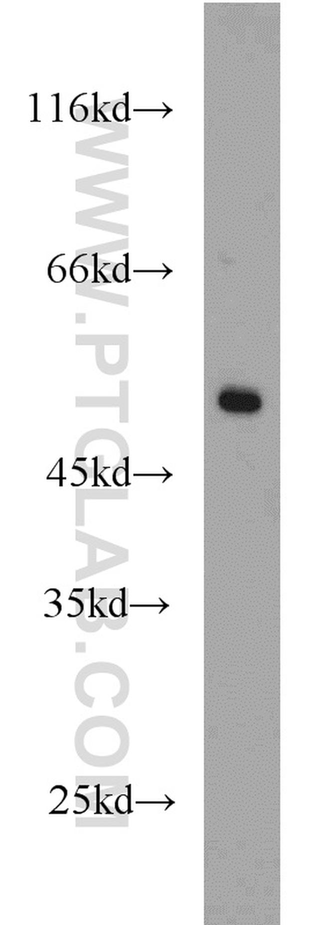 MRPL37 Antibody in Western Blot (WB)