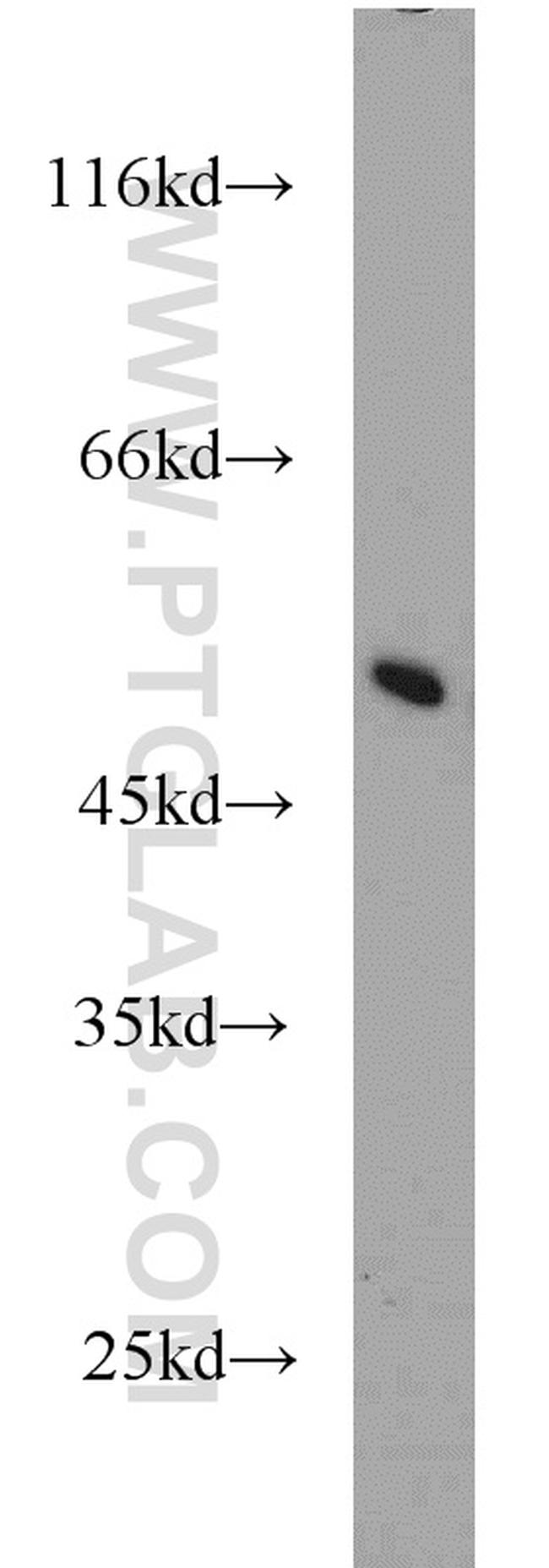 MRPL37 Antibody in Western Blot (WB)