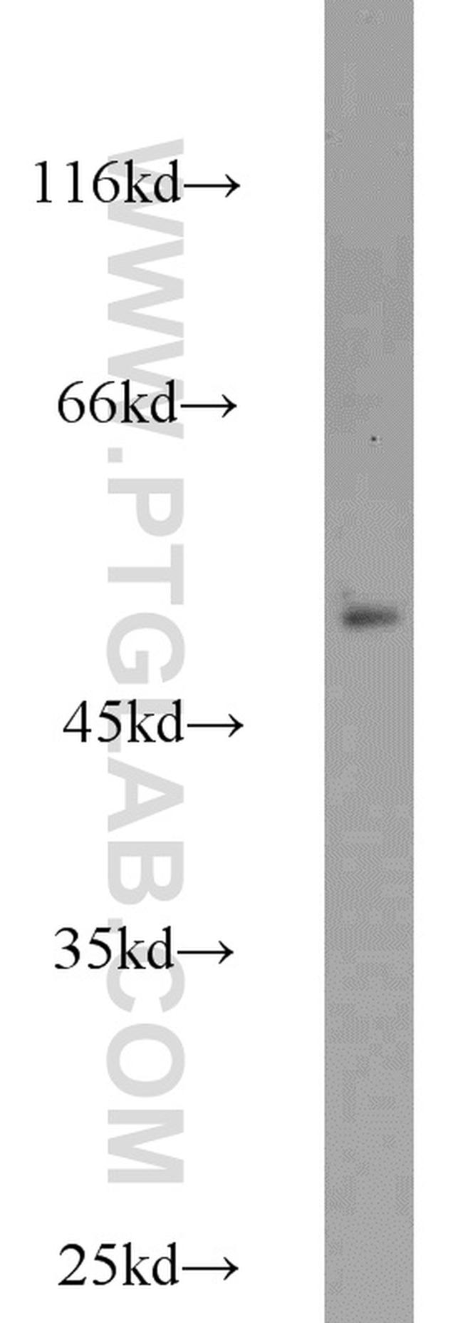 MRPL37 Antibody in Western Blot (WB)