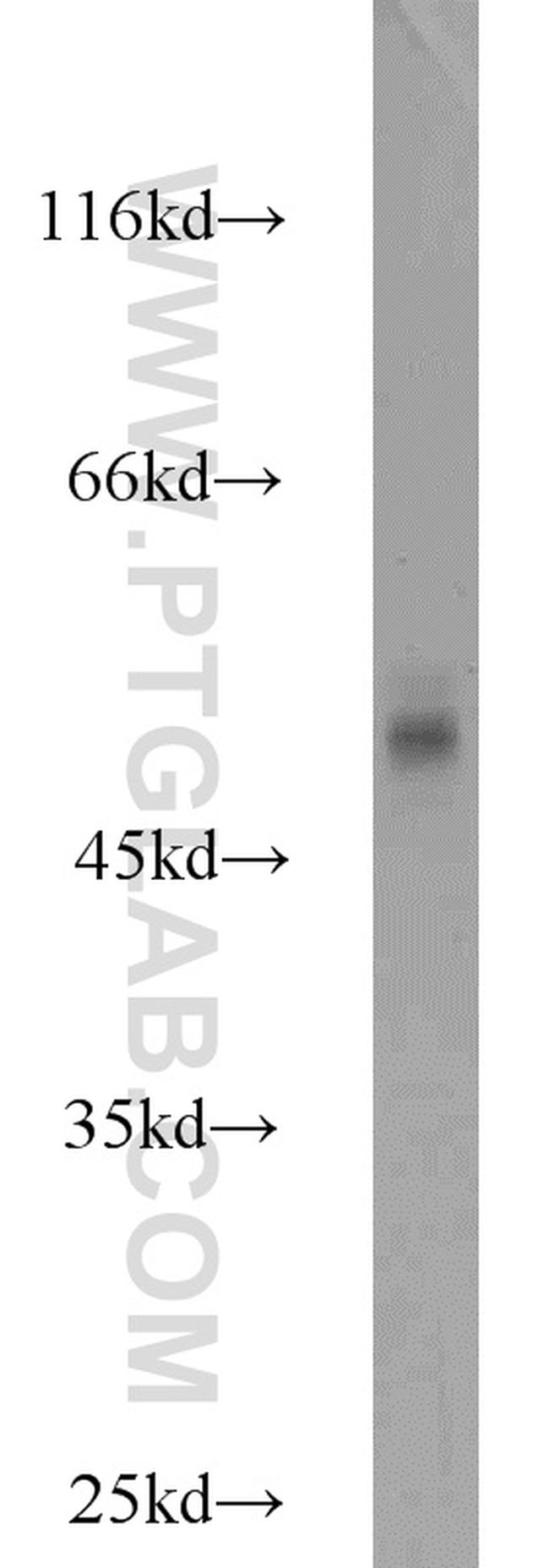 MRPL37 Antibody in Western Blot (WB)