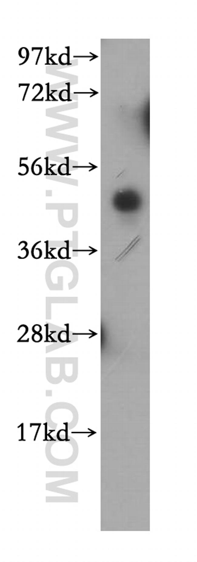 MRPL37 Antibody in Western Blot (WB)