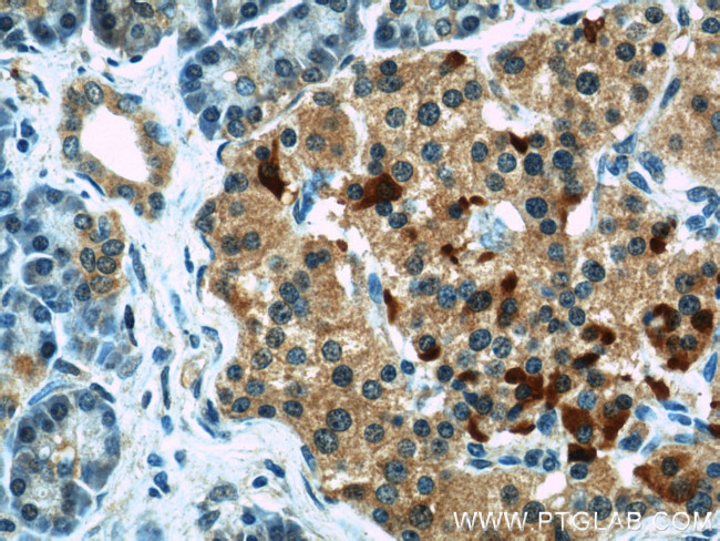 COL4A3BP Antibody in Immunohistochemistry (Paraffin) (IHC (P))