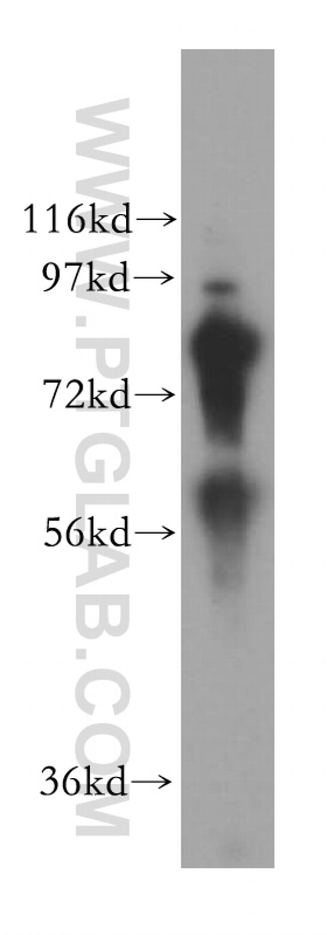 COL4A3BP Antibody in Western Blot (WB)