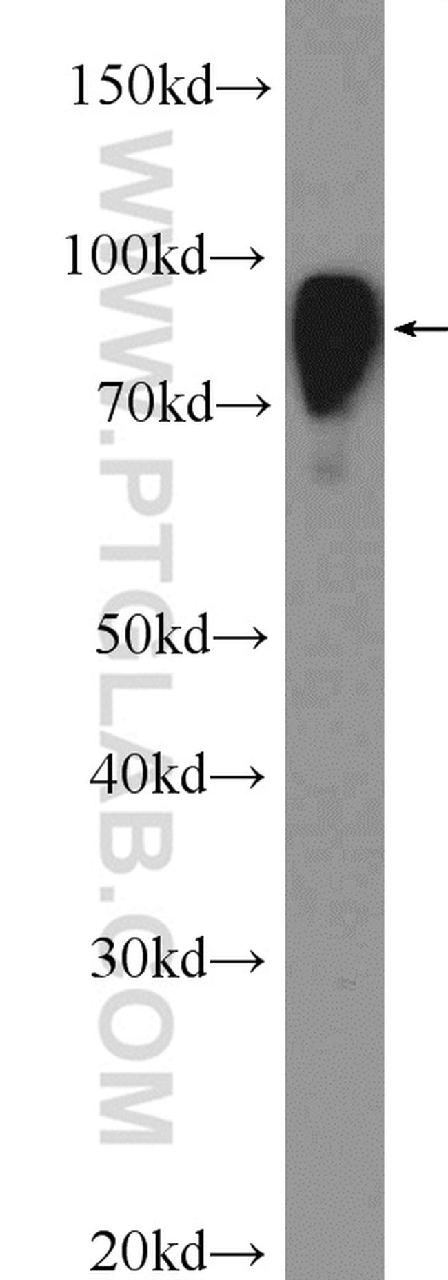 COL4A3BP Antibody in Western Blot (WB)