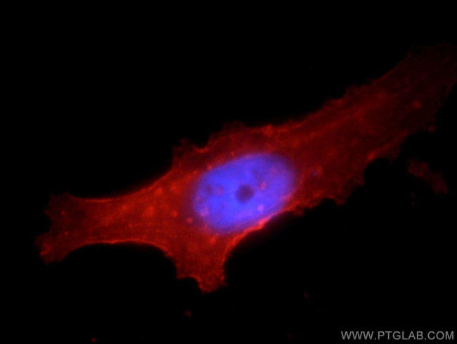 CD98 Antibody in Immunocytochemistry (ICC/IF)