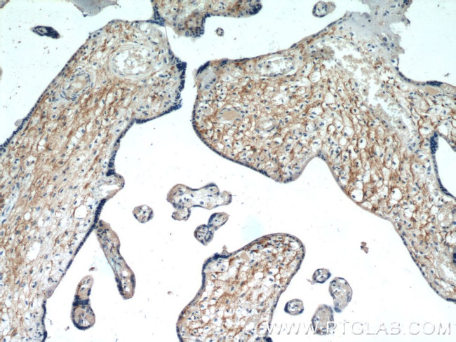 CD98 Antibody in Immunohistochemistry (Paraffin) (IHC (P))