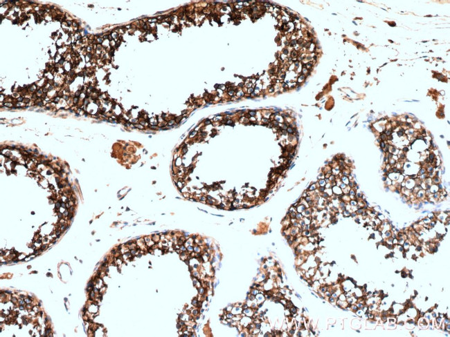 CD98 Antibody in Immunohistochemistry (Paraffin) (IHC (P))