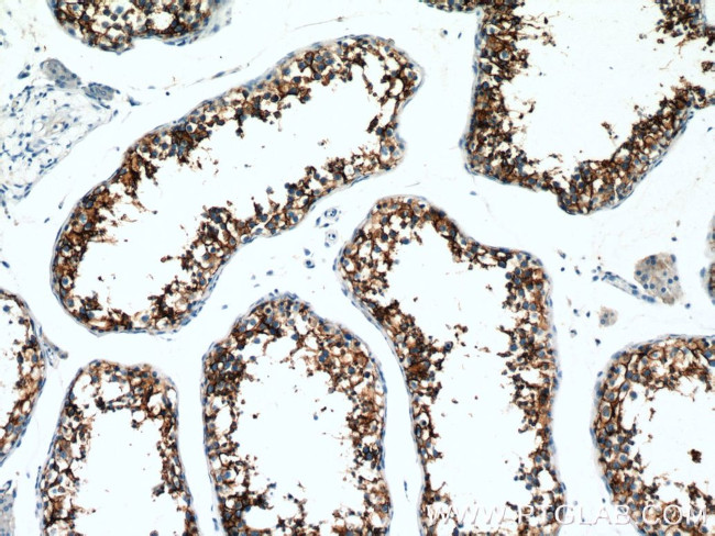 CD98 Antibody in Immunohistochemistry (Paraffin) (IHC (P))