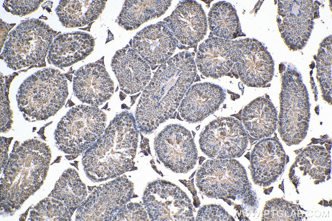 CD98 Antibody in Immunohistochemistry (Paraffin) (IHC (P))