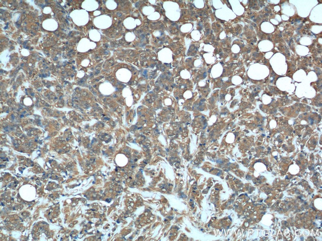 DHFR Antibody in Immunohistochemistry (Paraffin) (IHC (P))