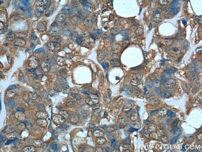 DHFR Antibody in Immunohistochemistry (Paraffin) (IHC (P))