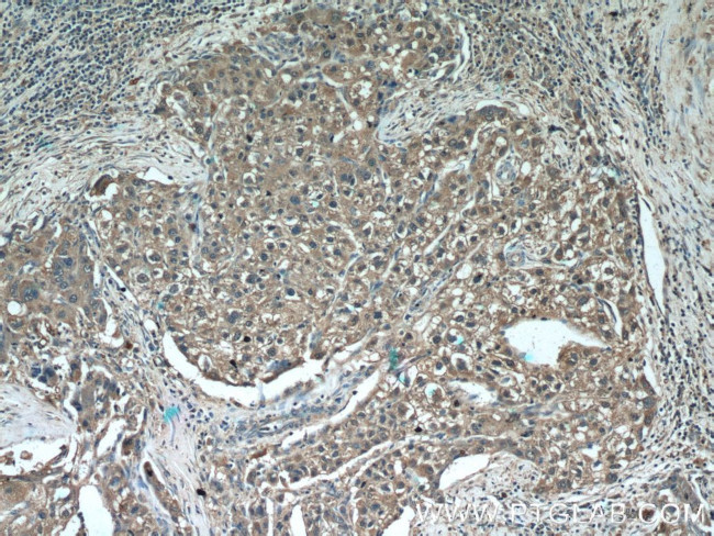 DHFR Antibody in Immunohistochemistry (Paraffin) (IHC (P))