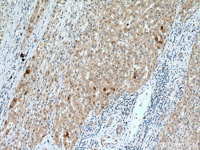 DHFR Antibody in Immunohistochemistry (Paraffin) (IHC (P))