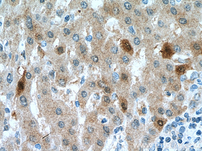 DHFR Antibody in Immunohistochemistry (Paraffin) (IHC (P))