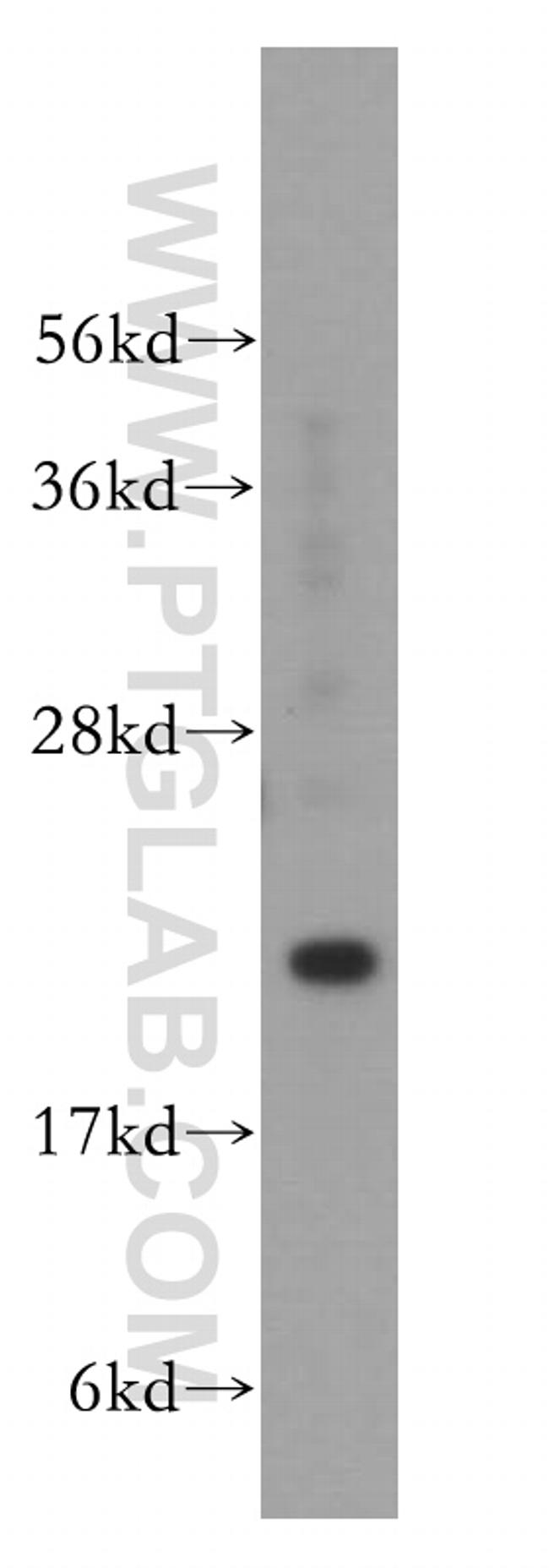 DHFR Antibody in Western Blot (WB)