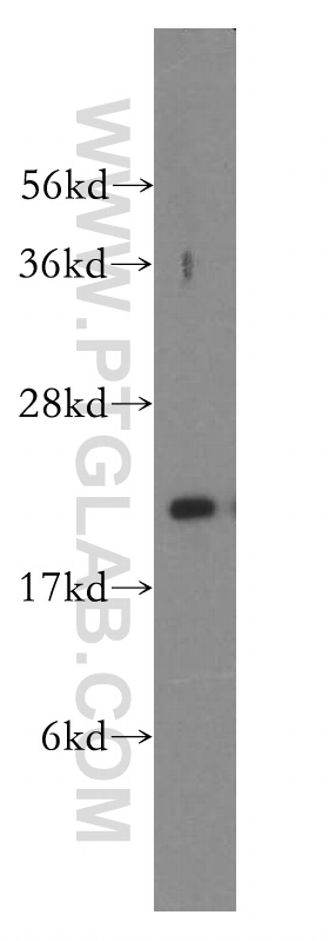 DHFR Antibody in Western Blot (WB)