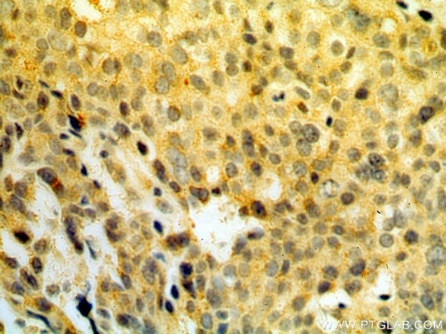 RPS3 Antibody in Immunohistochemistry (Paraffin) (IHC (P))