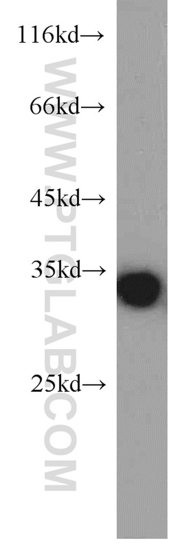 RPS3 Antibody in Western Blot (WB)