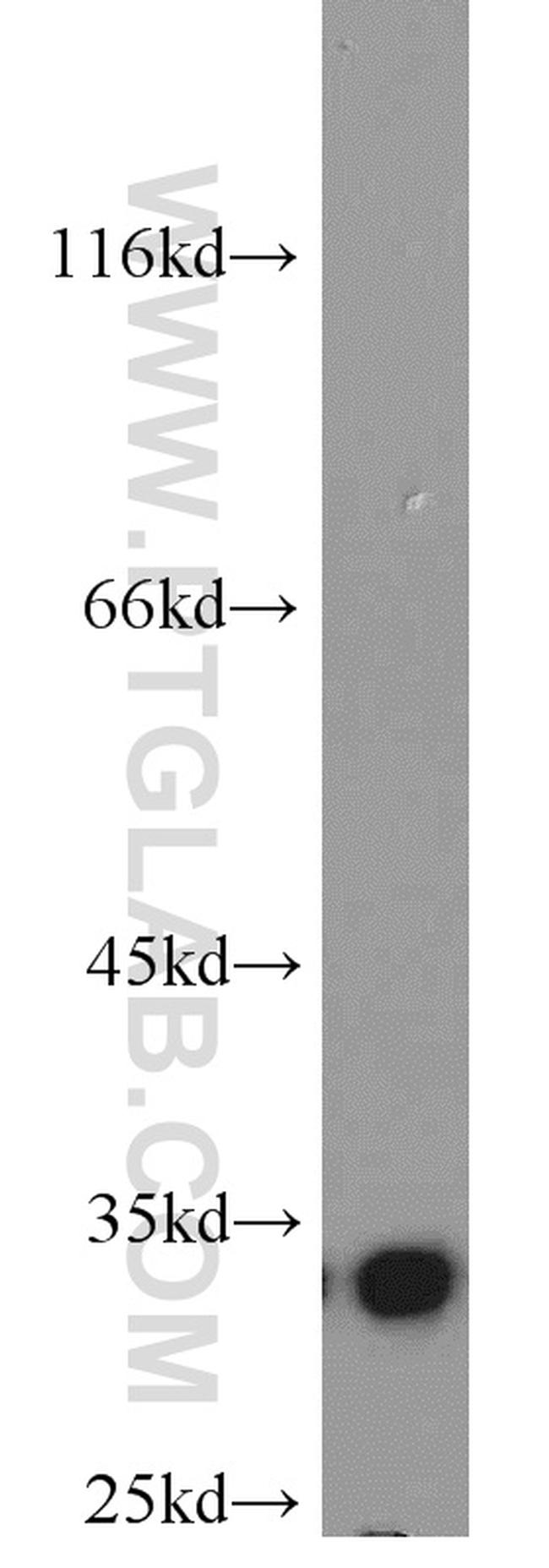 RPS3 Antibody in Western Blot (WB)