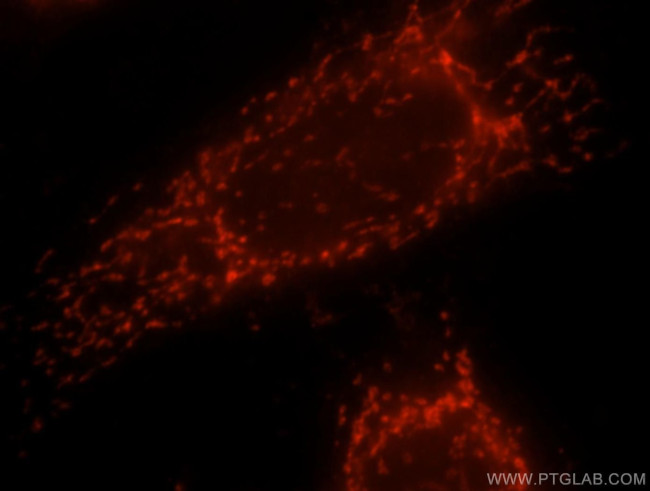 TMP21 Antibody in Immunocytochemistry (ICC/IF)