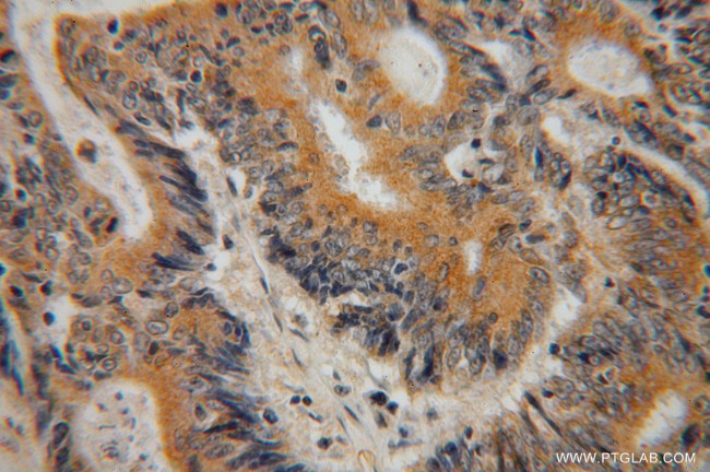 TMP21 Antibody in Immunohistochemistry (Paraffin) (IHC (P))