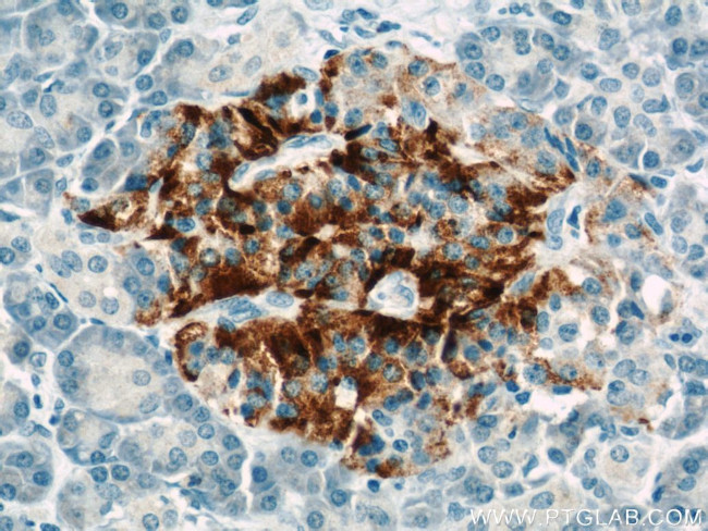 TMP21 Antibody in Immunohistochemistry (Paraffin) (IHC (P))