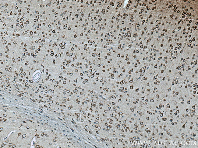 TMP21 Antibody in Immunohistochemistry (Paraffin) (IHC (P))