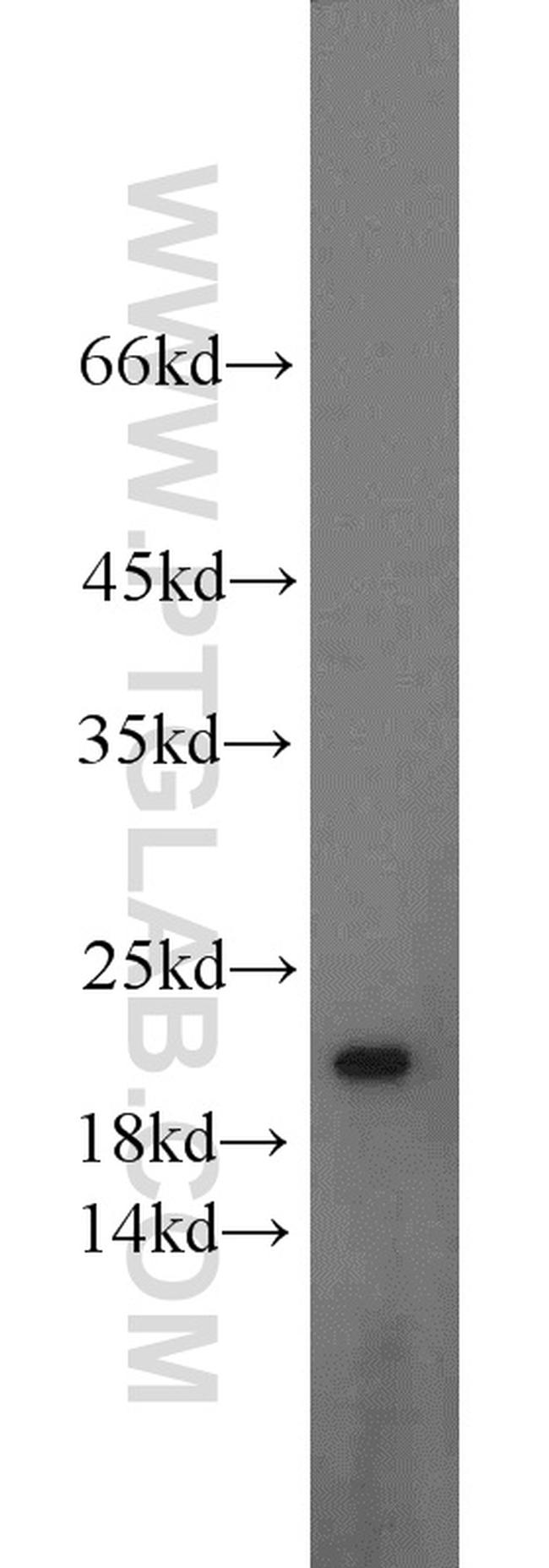 TMP21 Antibody in Western Blot (WB)