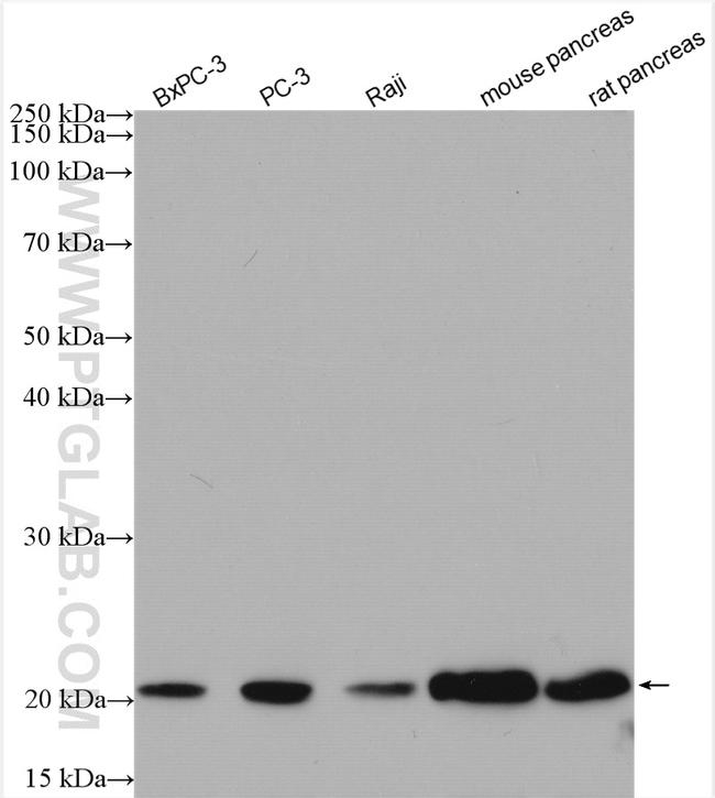 TMP21 Antibody in Western Blot (WB)