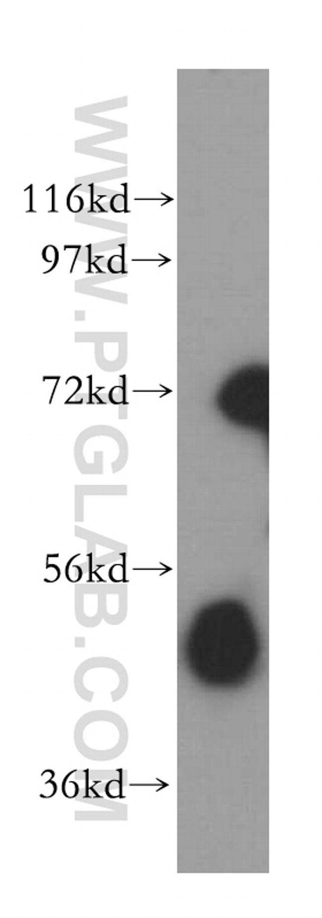 B4GALT4 Antibody in Western Blot (WB)