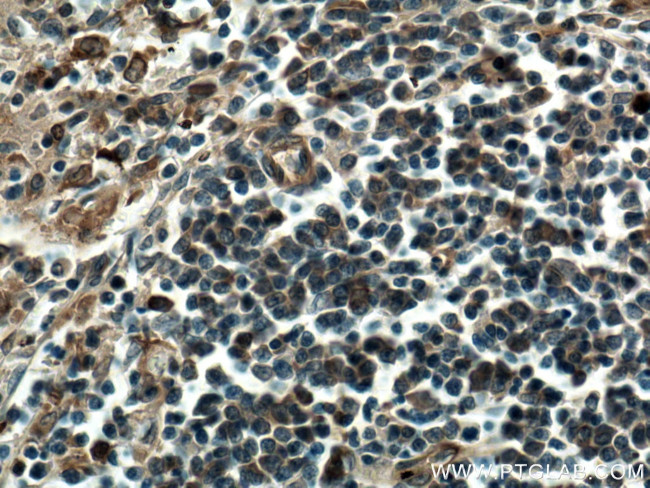 IFIT3 Antibody in Immunohistochemistry (Paraffin) (IHC (P))