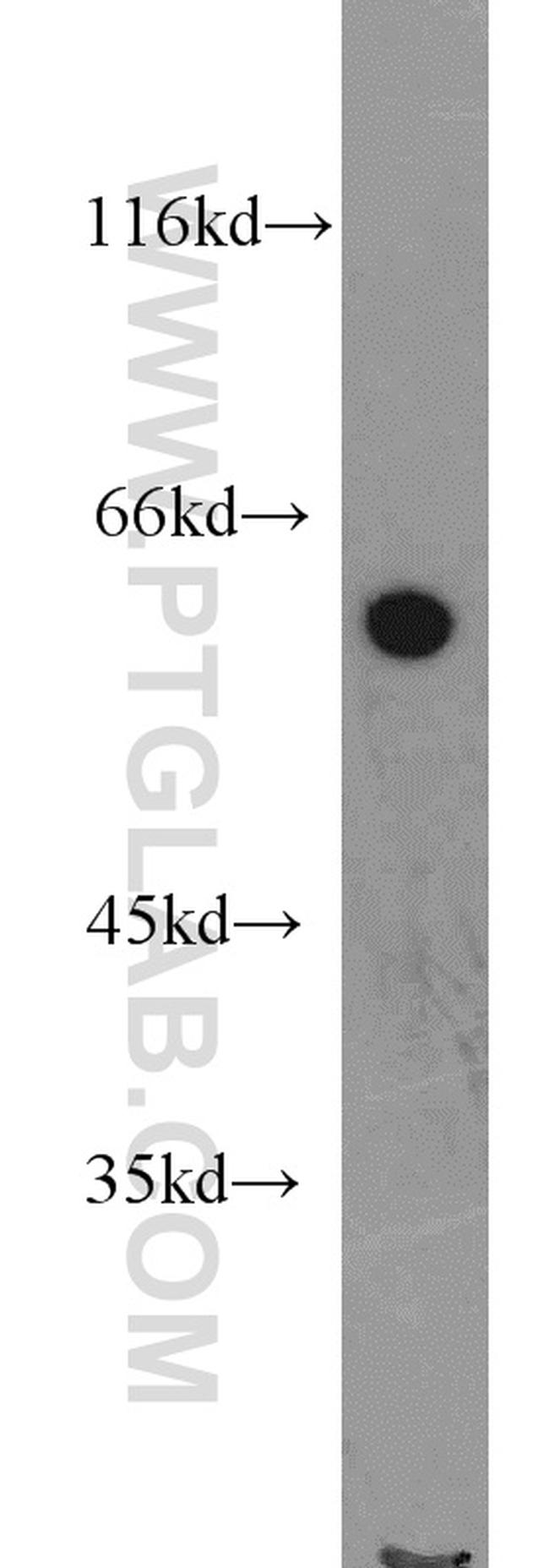 IFIT3 Antibody in Western Blot (WB)