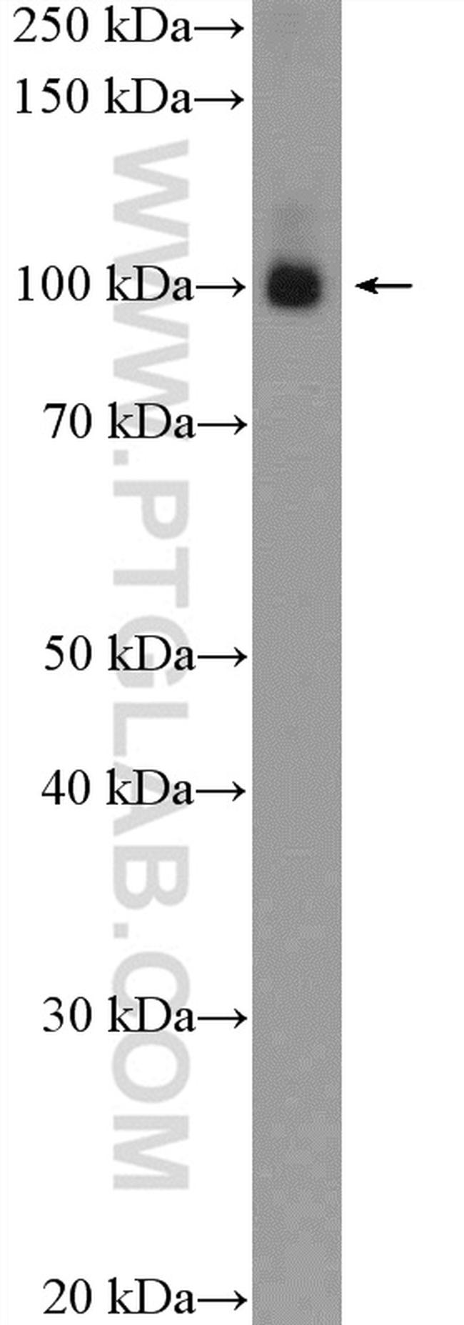 KAP1 Antibody in Western Blot (WB)