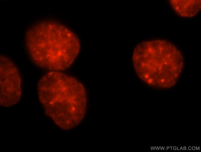 KAP1 Antibody in Immunocytochemistry (ICC/IF)