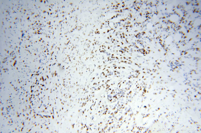 KAP1 Antibody in Immunohistochemistry (Paraffin) (IHC (P))