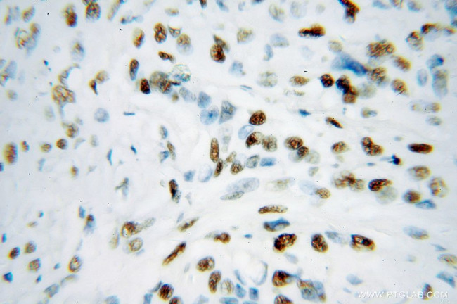 KAP1 Antibody in Immunohistochemistry (Paraffin) (IHC (P))