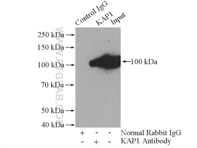 KAP1 Antibody in Immunoprecipitation (IP)