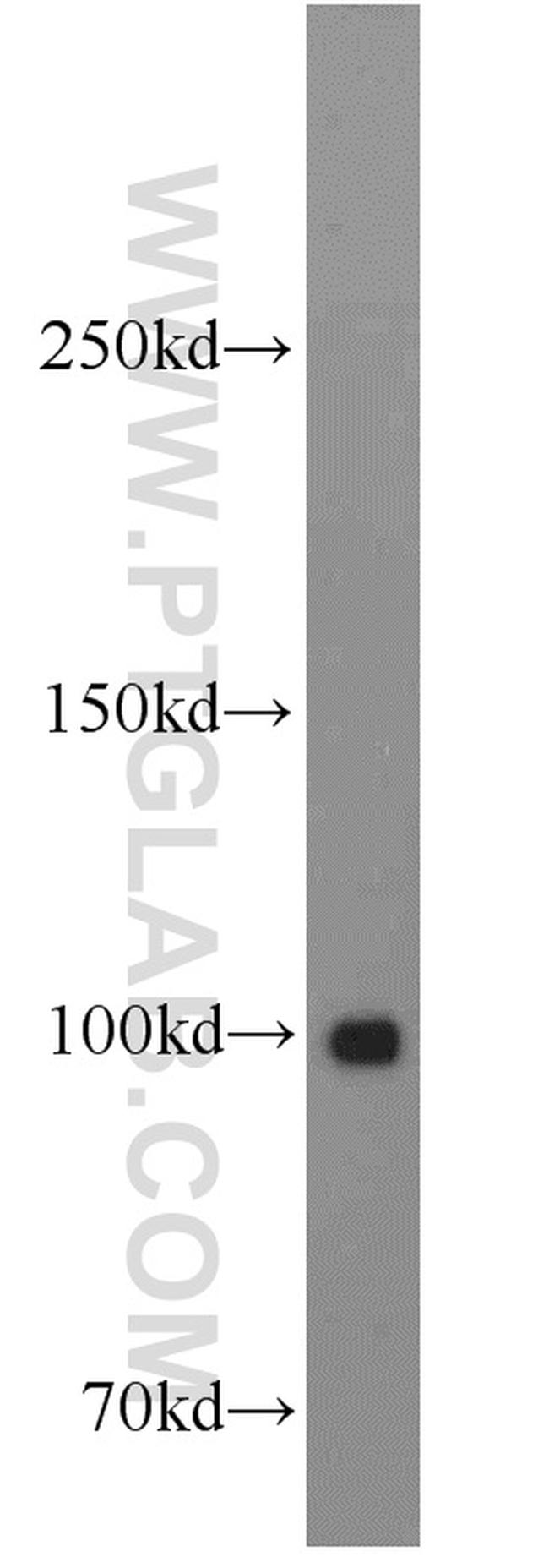 KAP1 Antibody in Western Blot (WB)