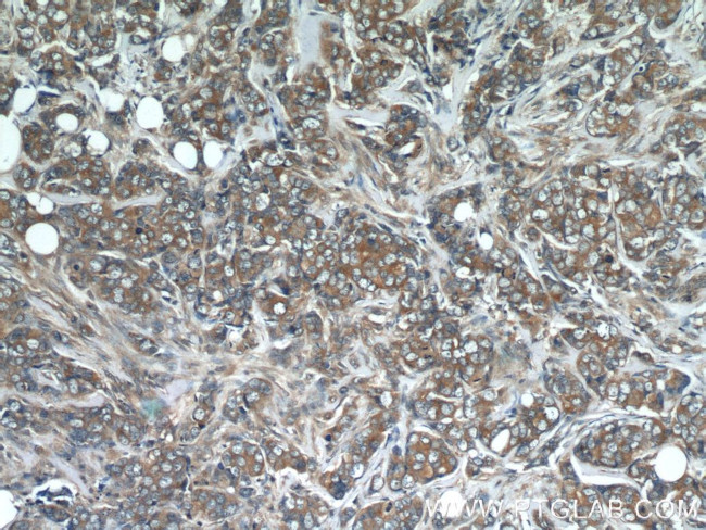 CHOP Antibody in Immunohistochemistry (Paraffin) (IHC (P))